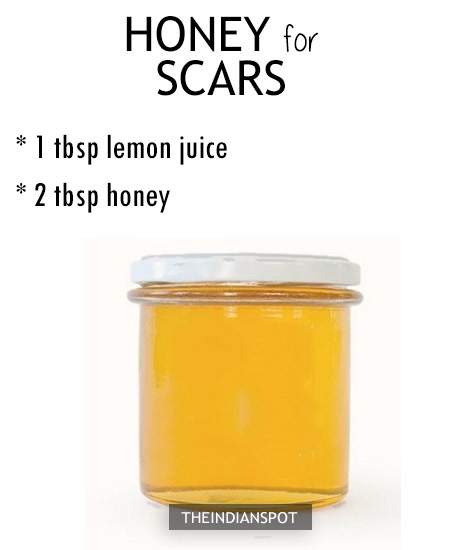 To treat dark spots or scars with honey, mix equal amounts of honey 