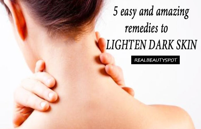 5 Easy and Amazing Remedies to Lighten dark skin