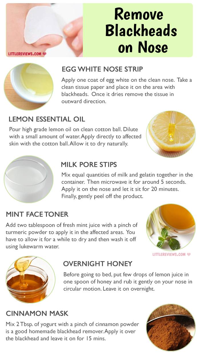 GET RID OF BLACKHEADS ON NOSE