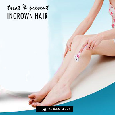 Treat and Prevent Ingrown Hair