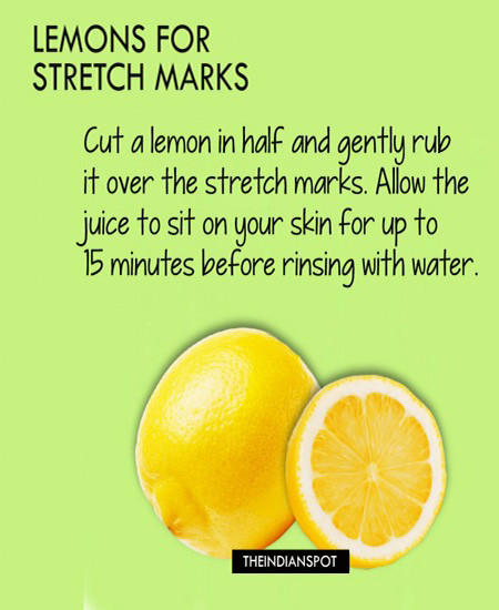The natural acids in lemon juice can help fade and bleach stretch mark. 