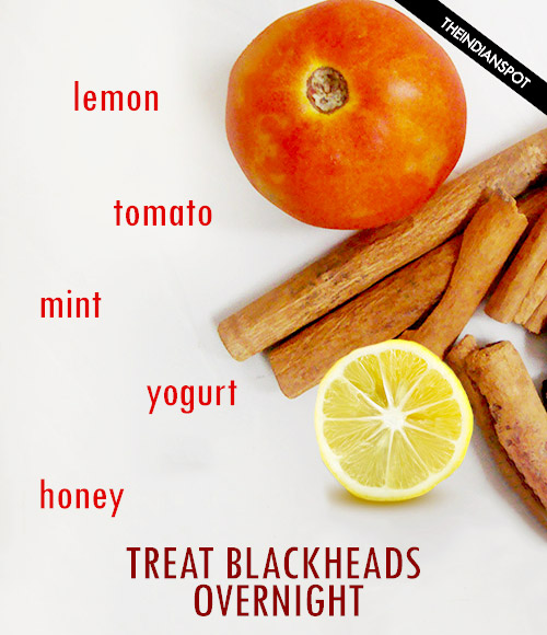 Treat Blackheads Overnight with natural remedies