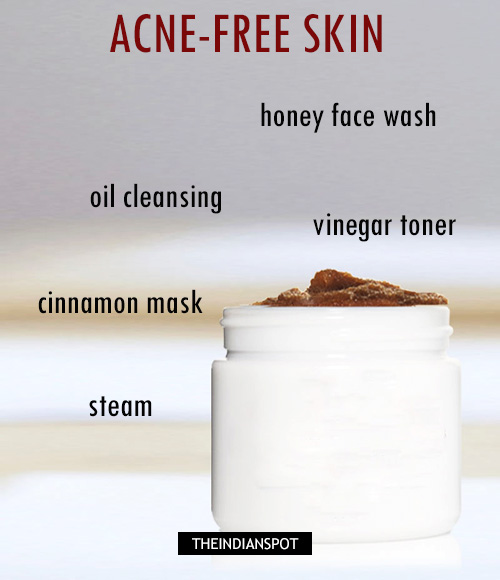 Natural remedies to acne-free skin