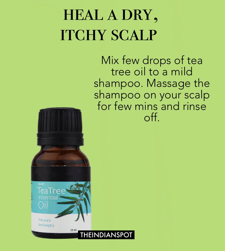 Itchy Scalp Shampoo