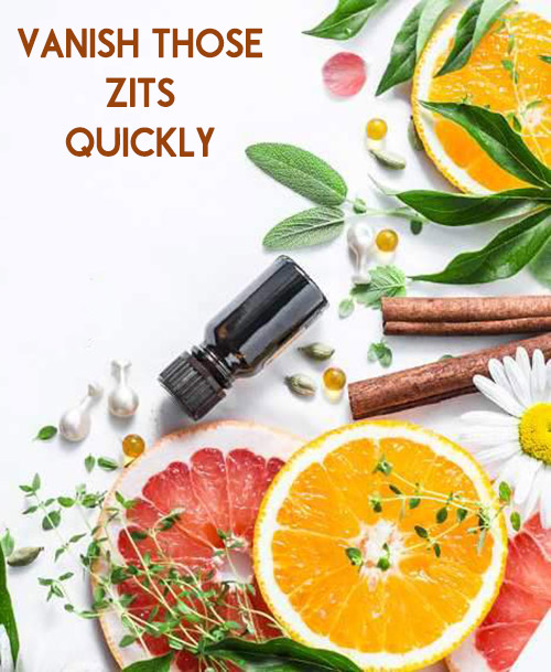 Vanish Those Zits Quickly With Easy Home Remedies