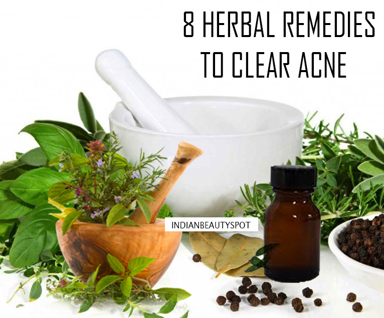 8 Herbal remedies to clear acne