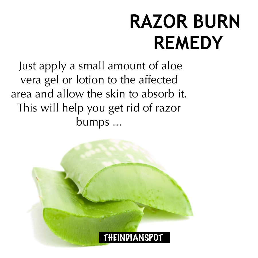 top home remedies to get rid of razor burn