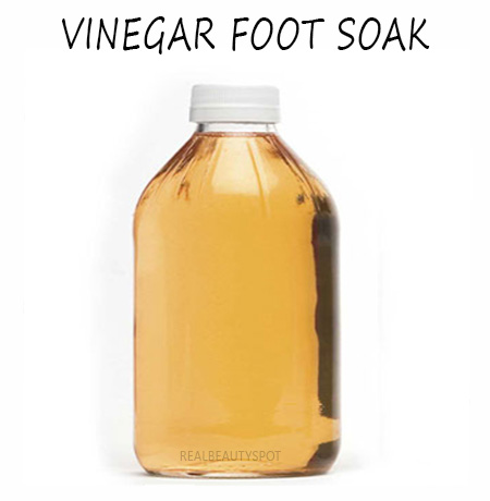 Vinegar foot soak