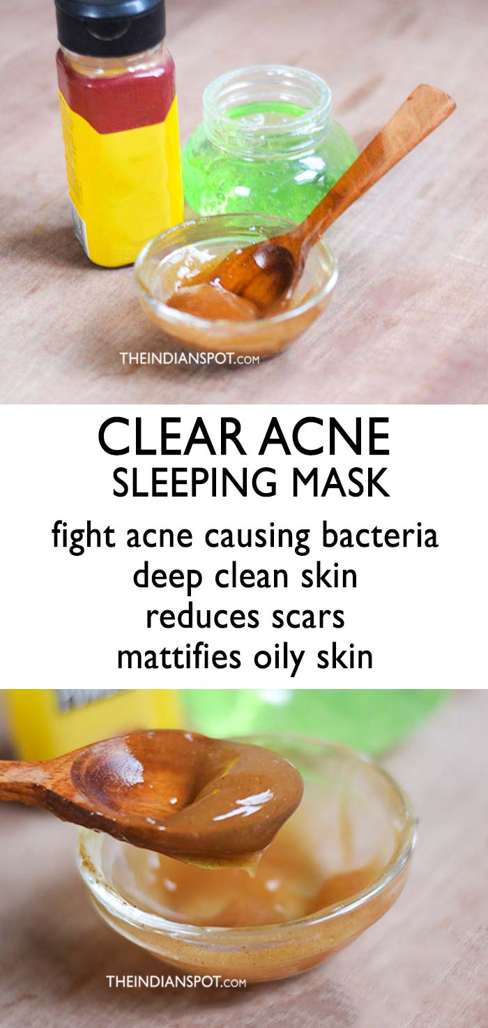 5 Best Natural Acne clearing facial masks