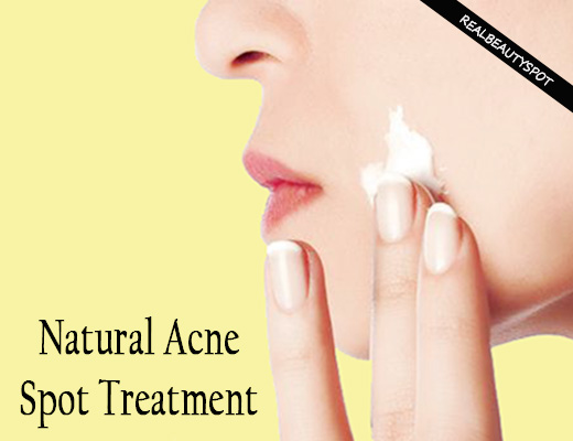 DIY Natural Acne Spot Treatment Ideas