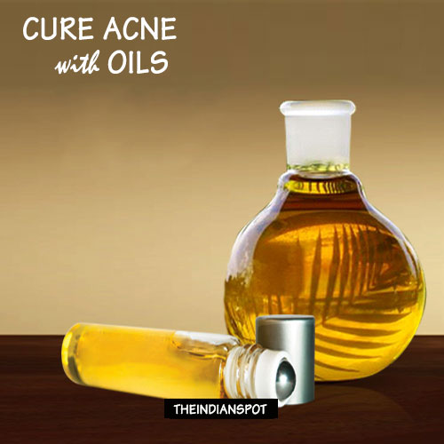 Cure Acne naturally with Oils