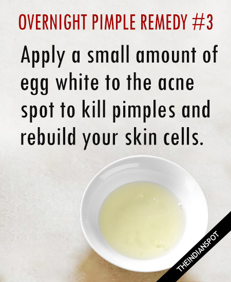 Natural methods to remove pimples