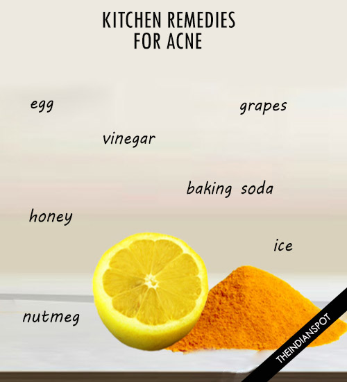 PROVEN KITCHEN REMEDIES FOR ACNE