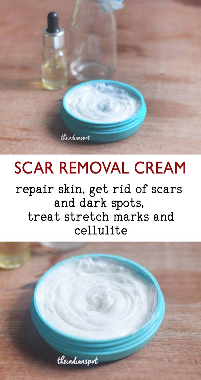 8 Simple Home Remedies For Scar Removal