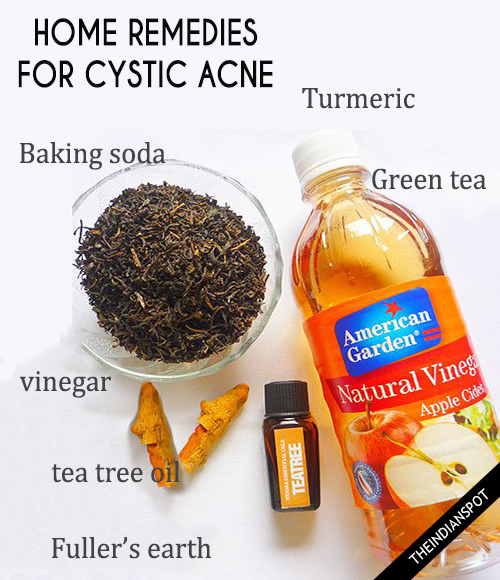 HOME REMEDIES FOR CYSTIC ACNE