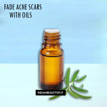 FADE ACNE SCARS WITH OILS