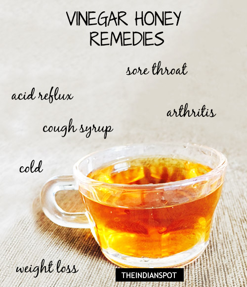 NATURAL CURES USING VINEGAR AND HONEY