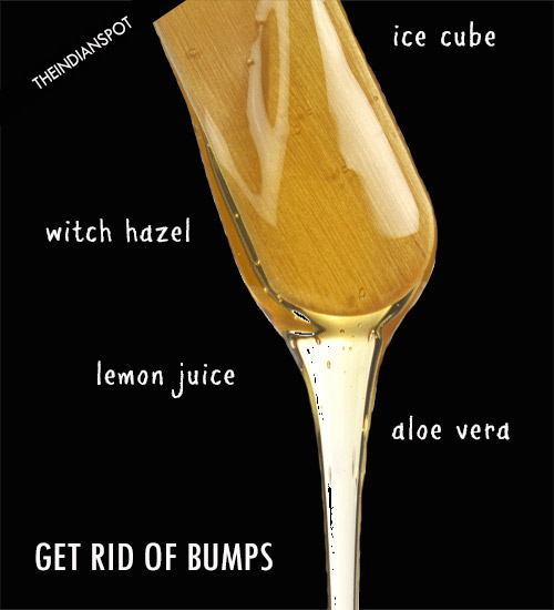 REMEDIES TO GET RID OF BUMPS AFTER  WAXING & SHAVING