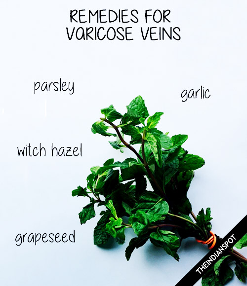 HOME REMEDIES FOR VARICOSE VEINS