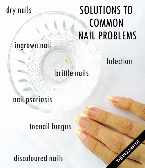 Solutions To Common Nail Problems