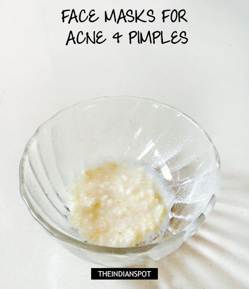 HOMEMADE FACE MASKS FOR ACNE & PIMPLES