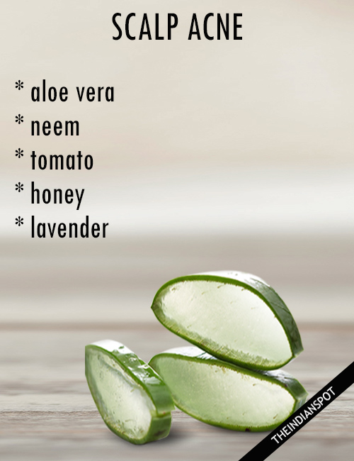 REMEDIES FOR SCALP ACNE