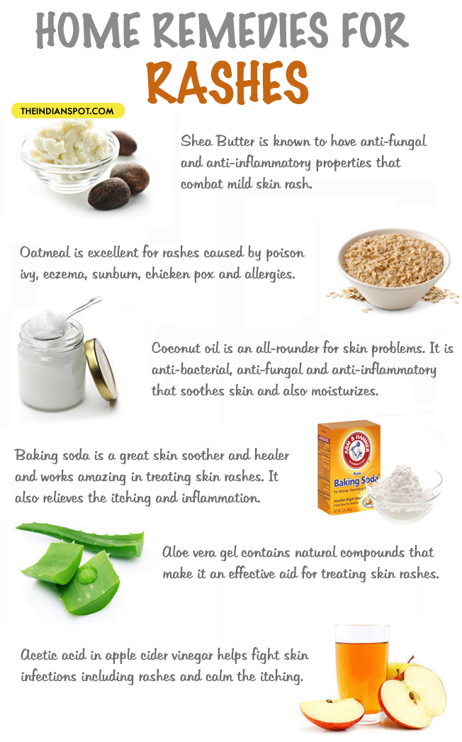 HOME REMEDIES FOR RASHES
