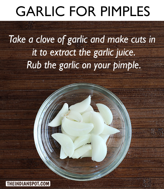 GARLIC REMEDY FOR PIMPLES
