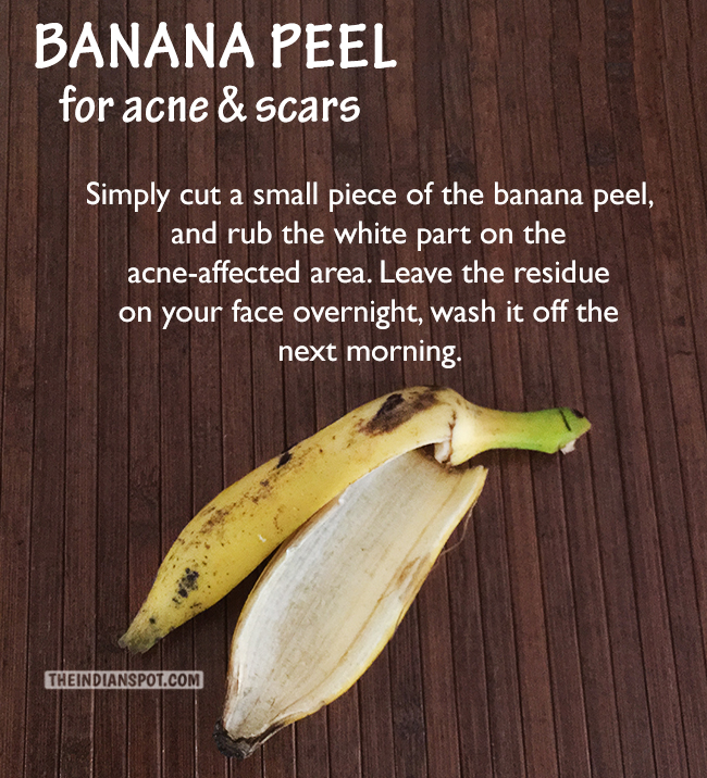 Overnight Acne scars remedy with banana peel