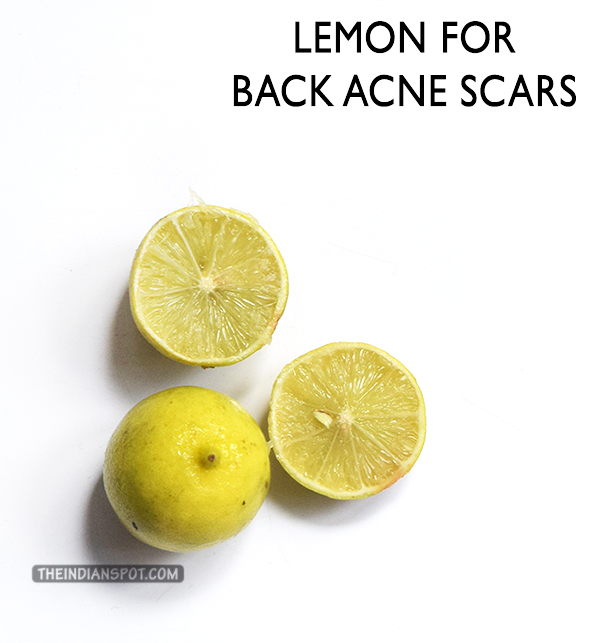 LEMON FOR BACK ACNE SCARS 