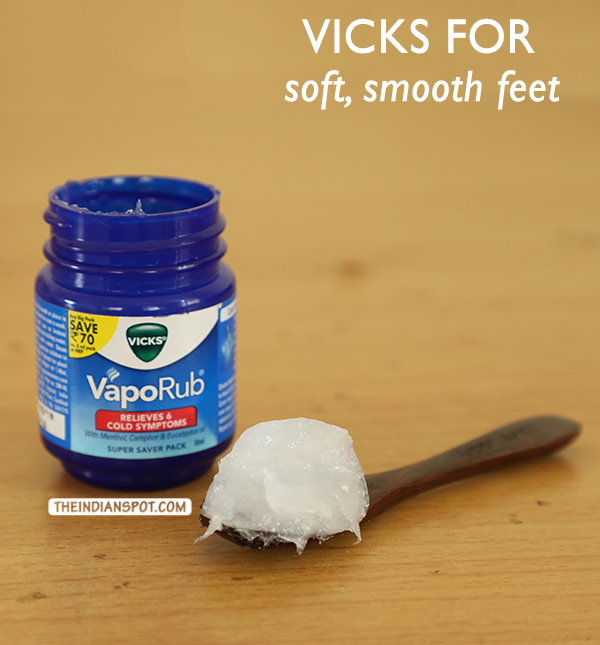 VICKS REMEDY FOR DRY CRACKED FEET