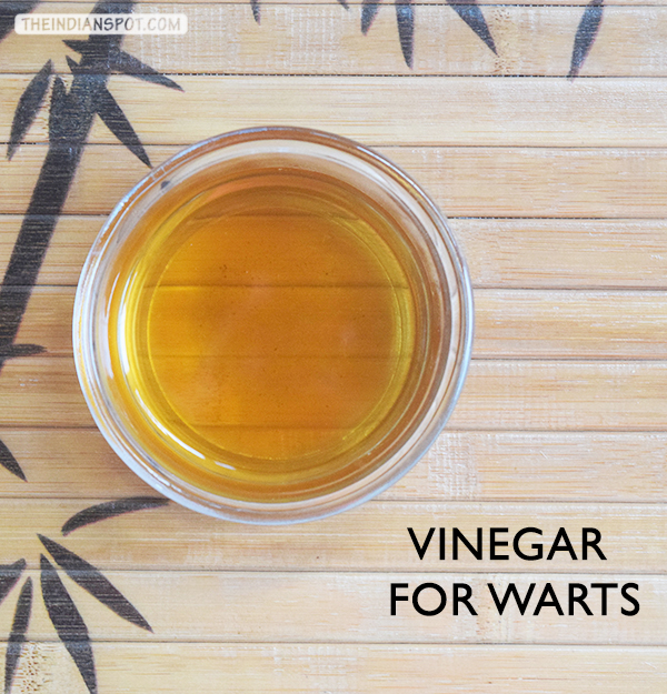 Home remedy for warts using vinegar