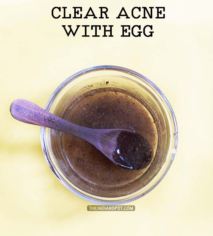  EGG MASK TO CLEAR ACNE