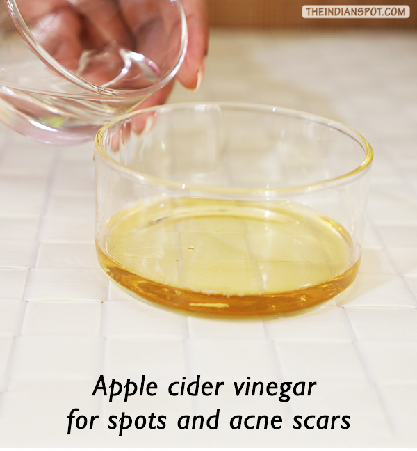 Apple cider vinegar for spots and acne scars