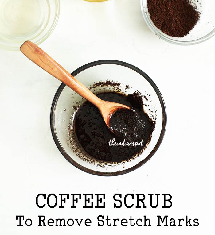 GET RID OF STRETCH MARKS WITH COFFEE