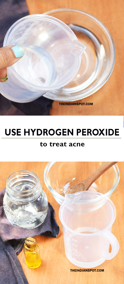 How To Use Hydrogen Peroxide To Treat Acne