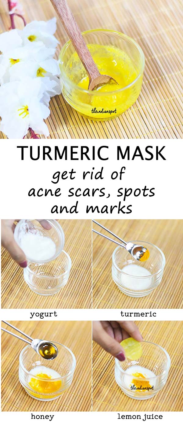 Naturally Fade Acne Scar and spots with