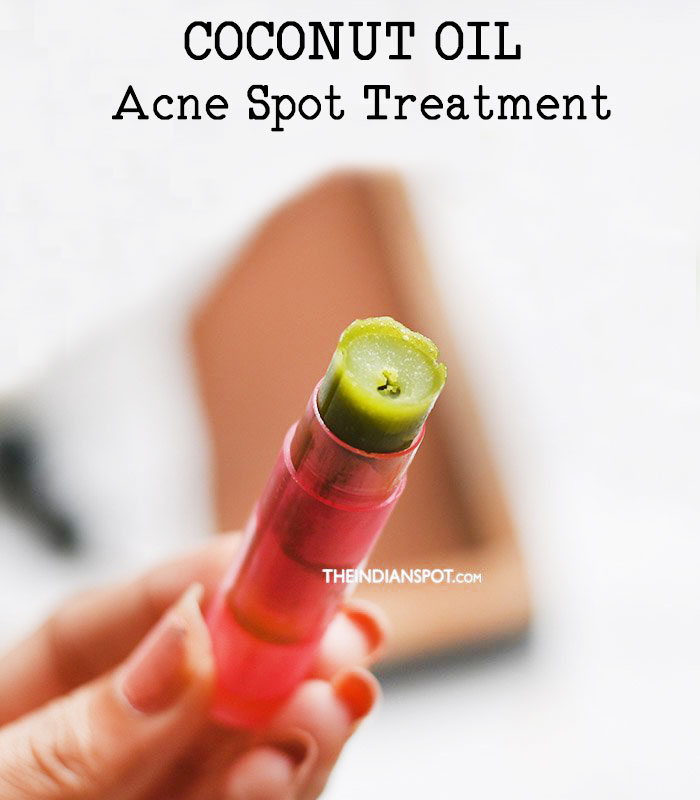 Clear Acne with Homemade Coconut oil Acne Spot Treatment